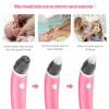 baby nasal aspirator electric safe hygienic nose cleaner snot sucker for baby (red) baby nasal aspirator electric safe hygienic nose cleaner snot sucker for baby (red)