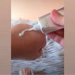 Hand applying cream from tube onto skin.