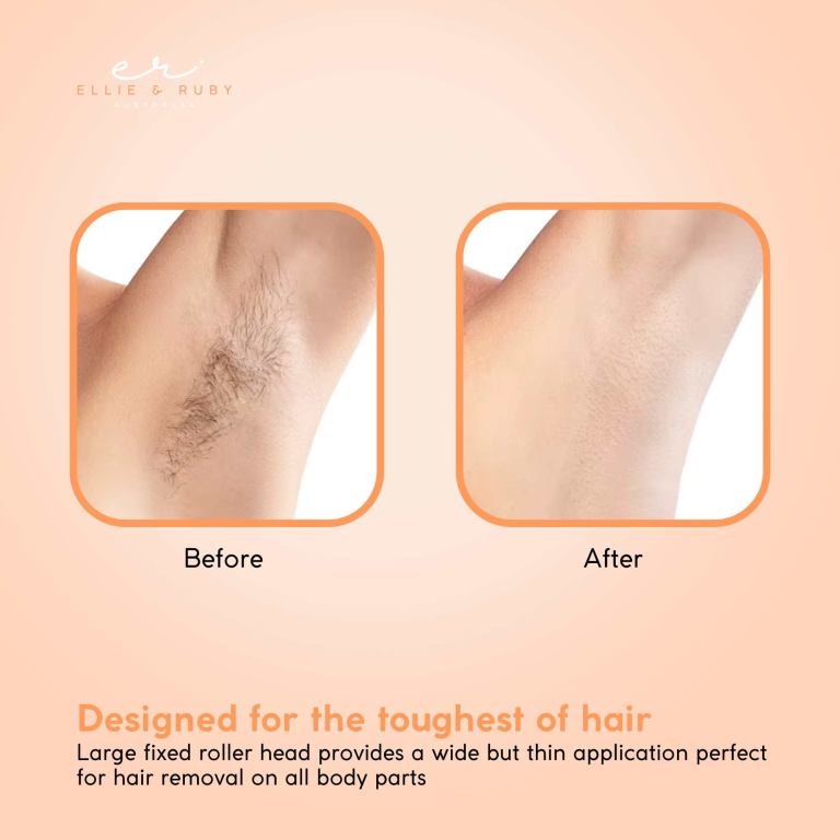ellie & ruby 100ml digital wax warmer + 100ml aloe vera cartridge pack Hair removal before and after results