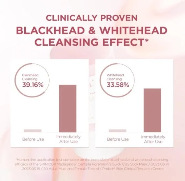Blackhead and whitehead cleansing results chart