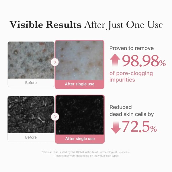 Skincare before and after results comparison close-up