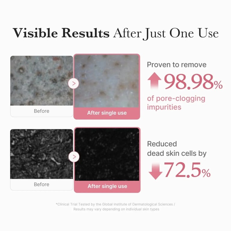 medicube pdrn pink niacinamide whip cleanser 120ml Skincare before and after results comparison close-up