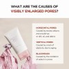 skin1004 madagascar centella poremizing light gel cream 2.53 fl.oz (75ml) Infographic on causes of visibly enlarged pores