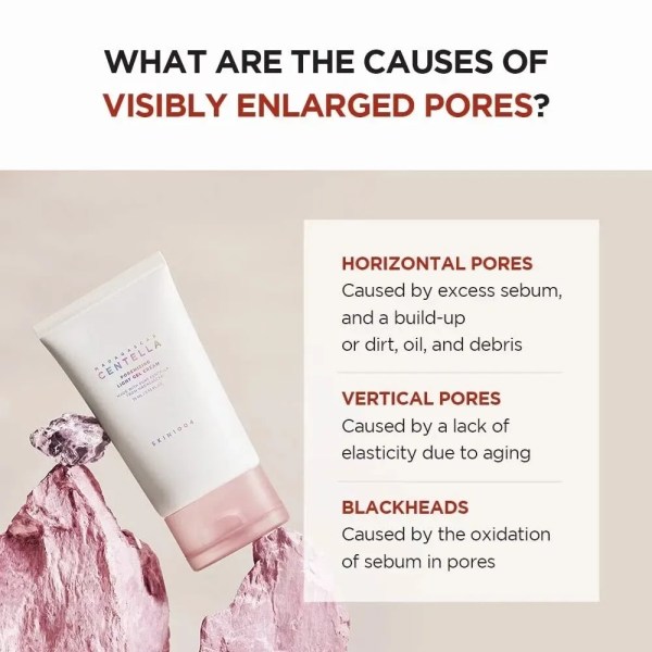 skin1004 madagascar centella poremizing light gel cream 2.53 fl.oz (75ml) Infographic on causes of visibly enlarged pores