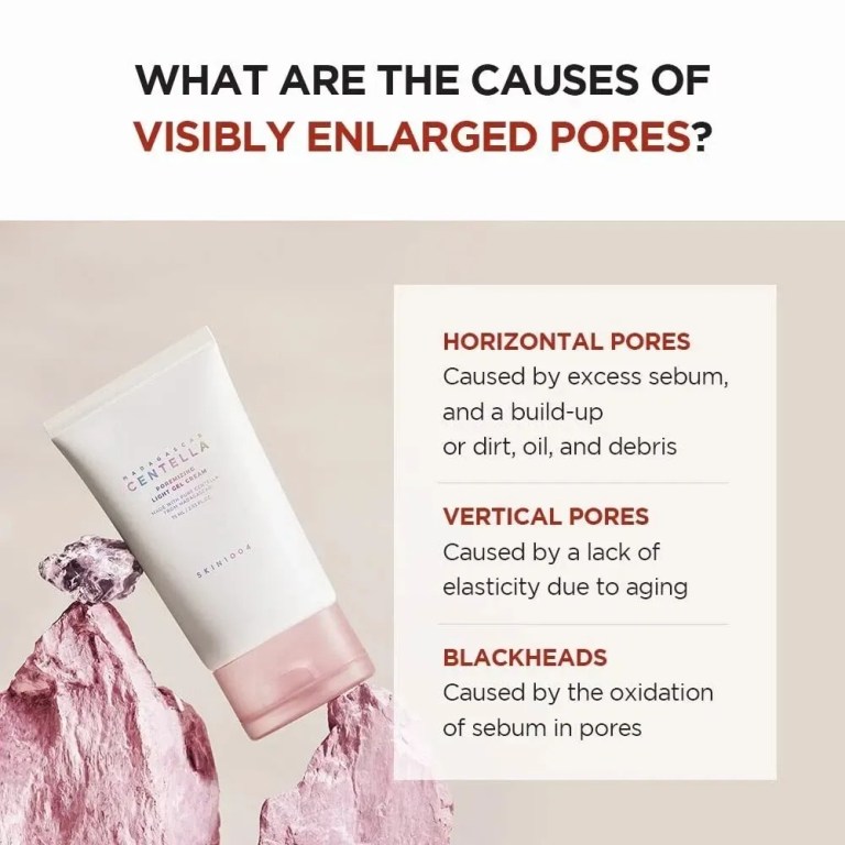 Infographic on causes of visibly enlarged pores