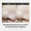 Before and after nose pore cleansing results