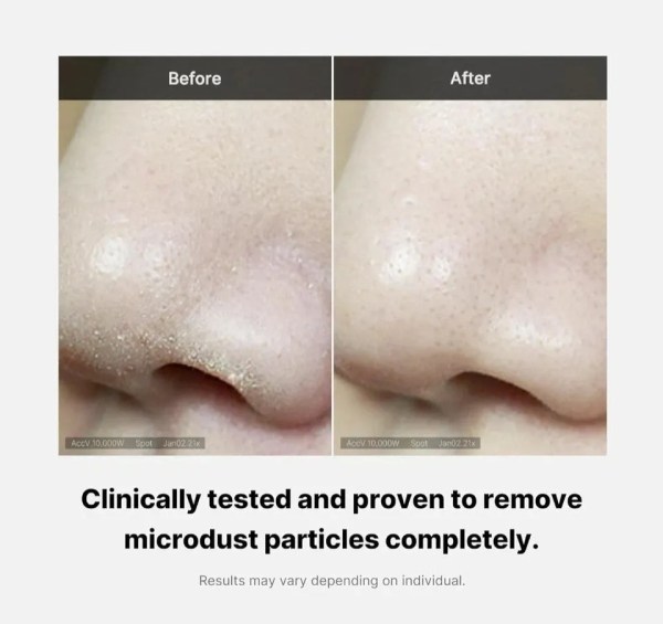 Before and after nose pore cleansing results